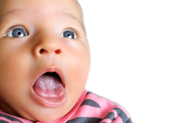 plaques blanches sur la langue d’un bébé atteinte de muguet buccal bébé