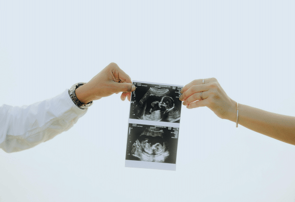 échographie de datation tenue par un professionnel de santé pour estimer l’âge gestationnel