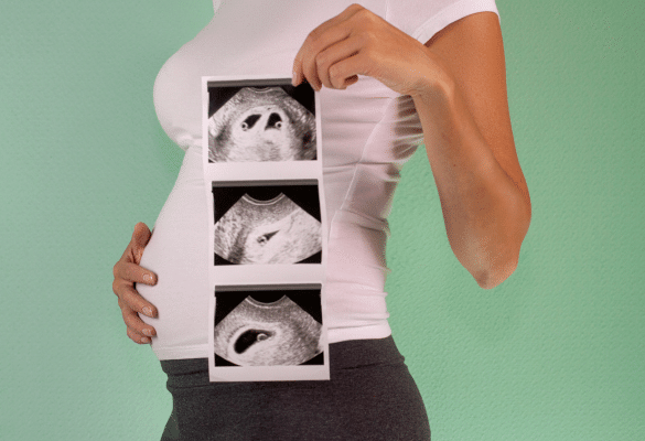 Femme enceinte tenant des clichés d’échographie montrant deux bébés, symbole de grossesse gémellaire.