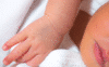 Pourquoi la peau de mon bébé pèle ?