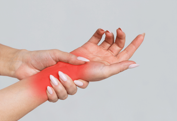 Illustration d’une main avec une zone rouge indiquant l’inflammation du poignet due au syndrome du canal carpien chez la femme enceinte.