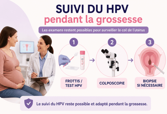 Illustration du suivi du HPV pendant la grossesse avec frottis, test HPV, colposcopie et biopsie si nécessaire